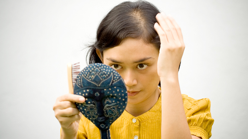 Alopecia, quanto ne sappiamo davvero?
